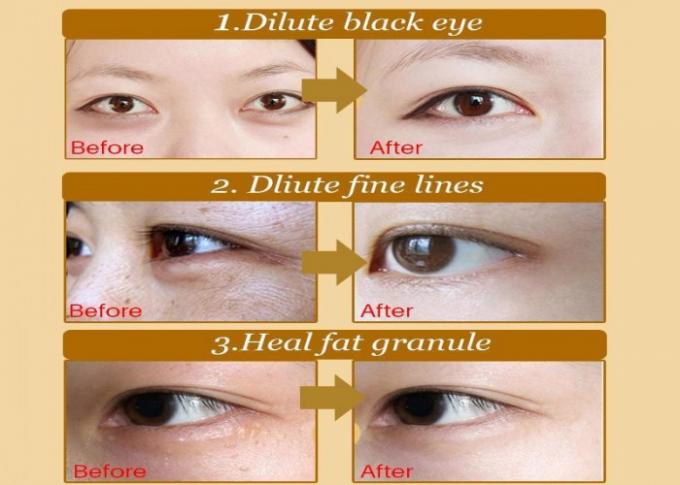 Kristallkollagen-Augen-Behandlungs-Maske, Rotwein-Gel unter Augenklappen für Falten